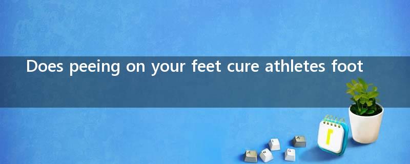 Does peeing on your feet cure athletes foot?